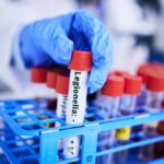 A gloved hand holding a test tube labeled 'Legionella' among other samples