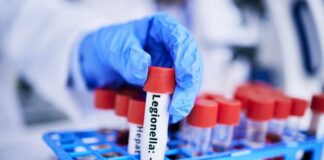 A gloved hand holding a test tube labeled 'Legionella' among other samples