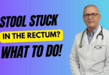Impacted Stool Explained: When Poop Gets Stuck in the Rectum