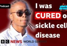 How a $2m treatment cured my sickle cell disease - What in the World podcast, BBC World Service