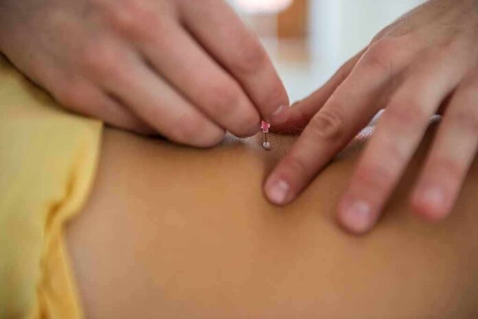 Hands inserting an acupuncture needle into a person's back